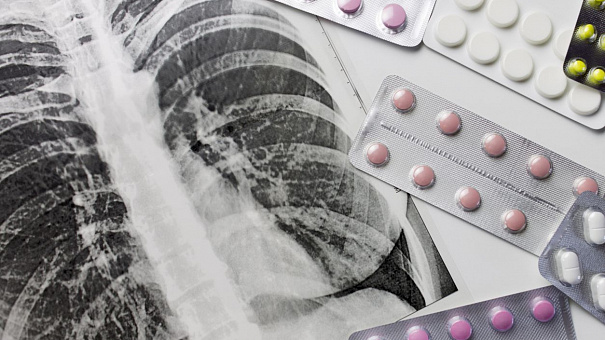 Стандарт медпомощи при туберкулёзе: препараты и их дозировки