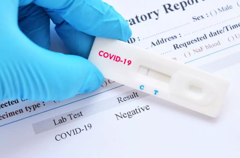 Интернет-ритейлеры сняли с продажи экспресс-тесты на антитела к коронавирусу после предостережения ФАС