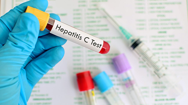 Стандарт медпомощи при остром гепатите С: препараты и их дозировки